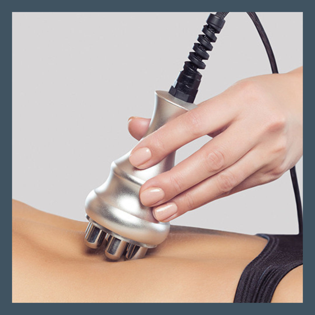 キャビテーション